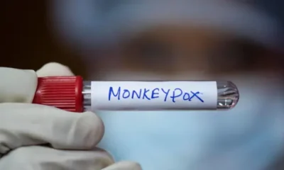 குரங்கு அம்மை